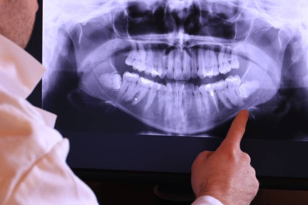 Best Broken Tooth Emergency  in East Peoria, IL