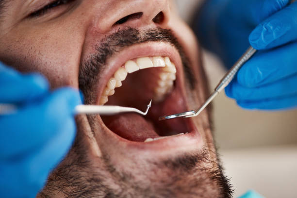 Best Knocked-Out Tooth Emergency  in East Peoria, IL
